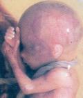 Fetus 14 weeks 120x141