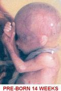 Fetus 14 weeks captioned 120 x 180