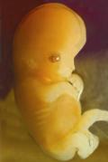 Fetus 7 weeks 120x179
