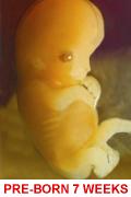 Fetus 7 weeks captioned 120x180