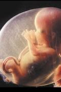 Fetus in amniotic sac 120