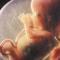 Fetus in amniotic sac 60 x 60