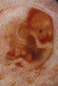 Young Fetus 120 x 176